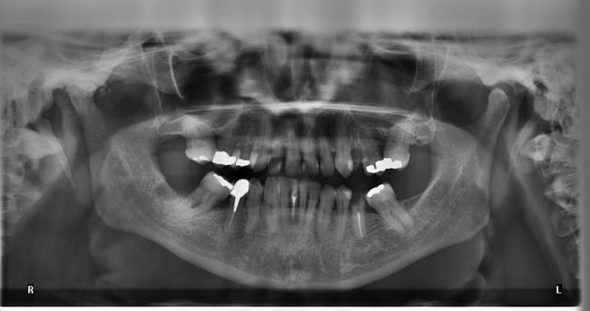 How to prevent dental diseases (1)